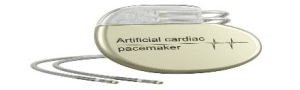 Vacuum Brazing of Heart Pacemaker Feedthroughs